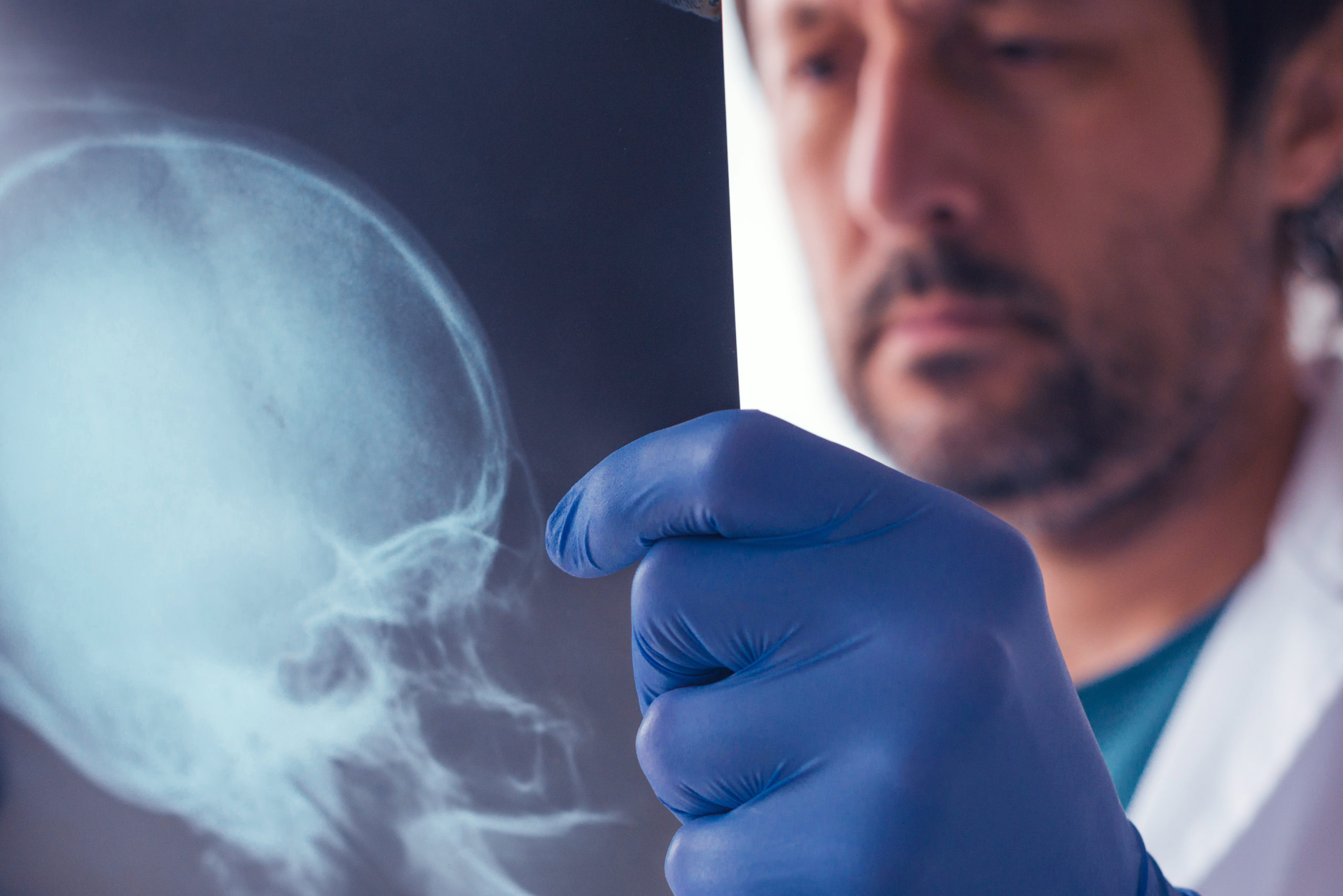 doctor examining skull x-ray
