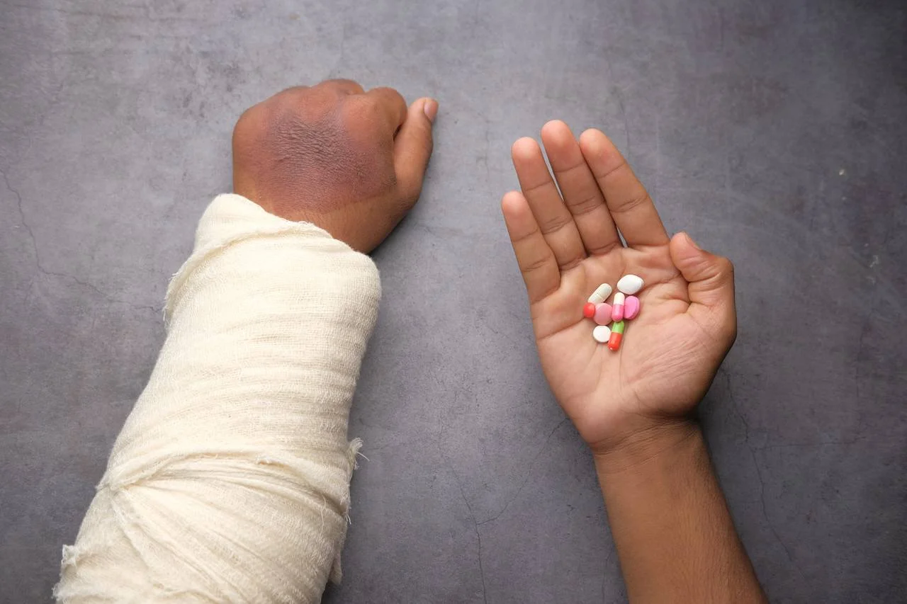 arm with cast and hand with pills